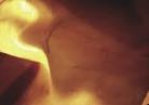 Feuer-Bild